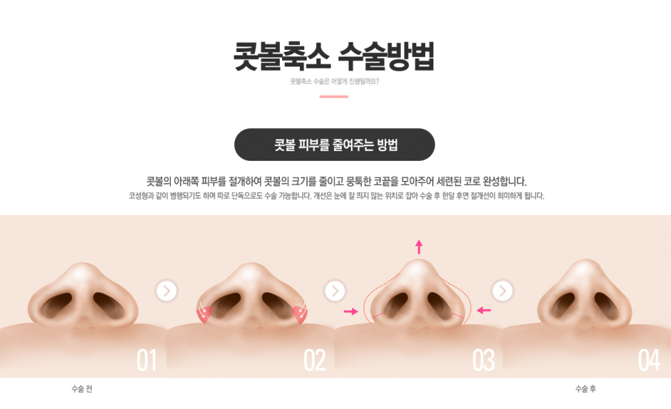 세련된 이미지를 원하신다면? 지금 바로 베리굿성형외과로! 관련 이미지 4