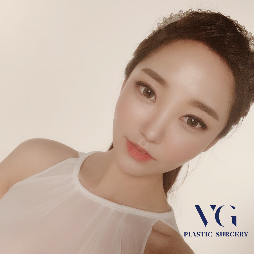 코필러? 턱필러? 필러후기 똑똑하게 알아보고 시술받자! 관련 이미지 2