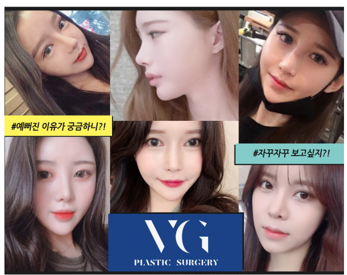 부유방, 팔 지방흡입 베리굿성형외과에서 모델같은 몸매! 관련 이미지 8