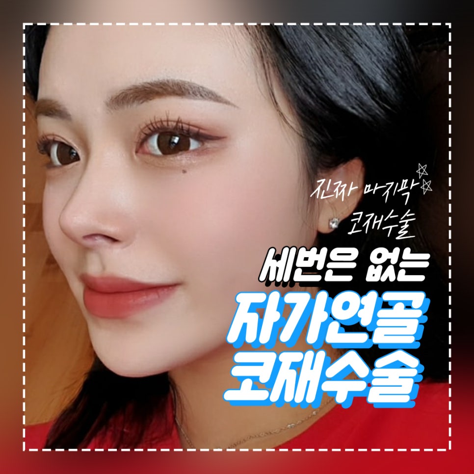 자가연골 코재수술, 기능코 또는 비염까지 한번에 해결 / 강남역 이비인후과 관련 이미지 1