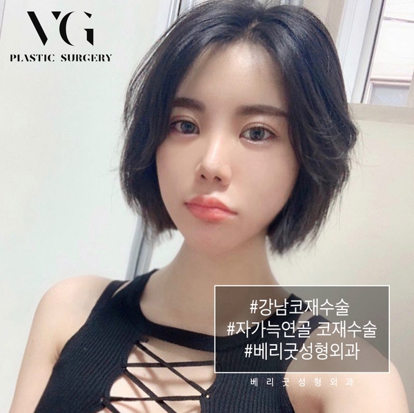 자가늑연골 코재수술 나도 해당될까? 관련 이미지 1