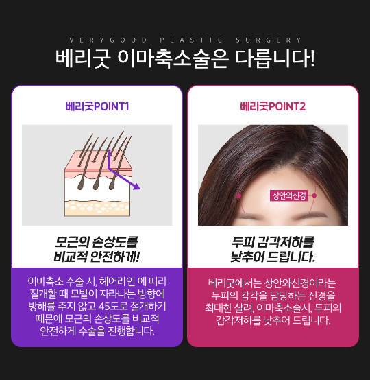 이마축소로 작고 아름다운 얼굴라인으로 변신! 관련 이미지 3