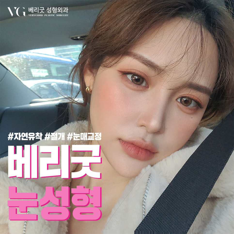 눈재수술도 베리굿하게😍베리굿성형외과 관련 이미지 1