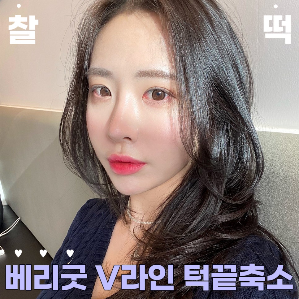 베리굿&hearts;얼굴에 찰떡! 베리굿 V라인 턱끝축소 관련 이미지 1
