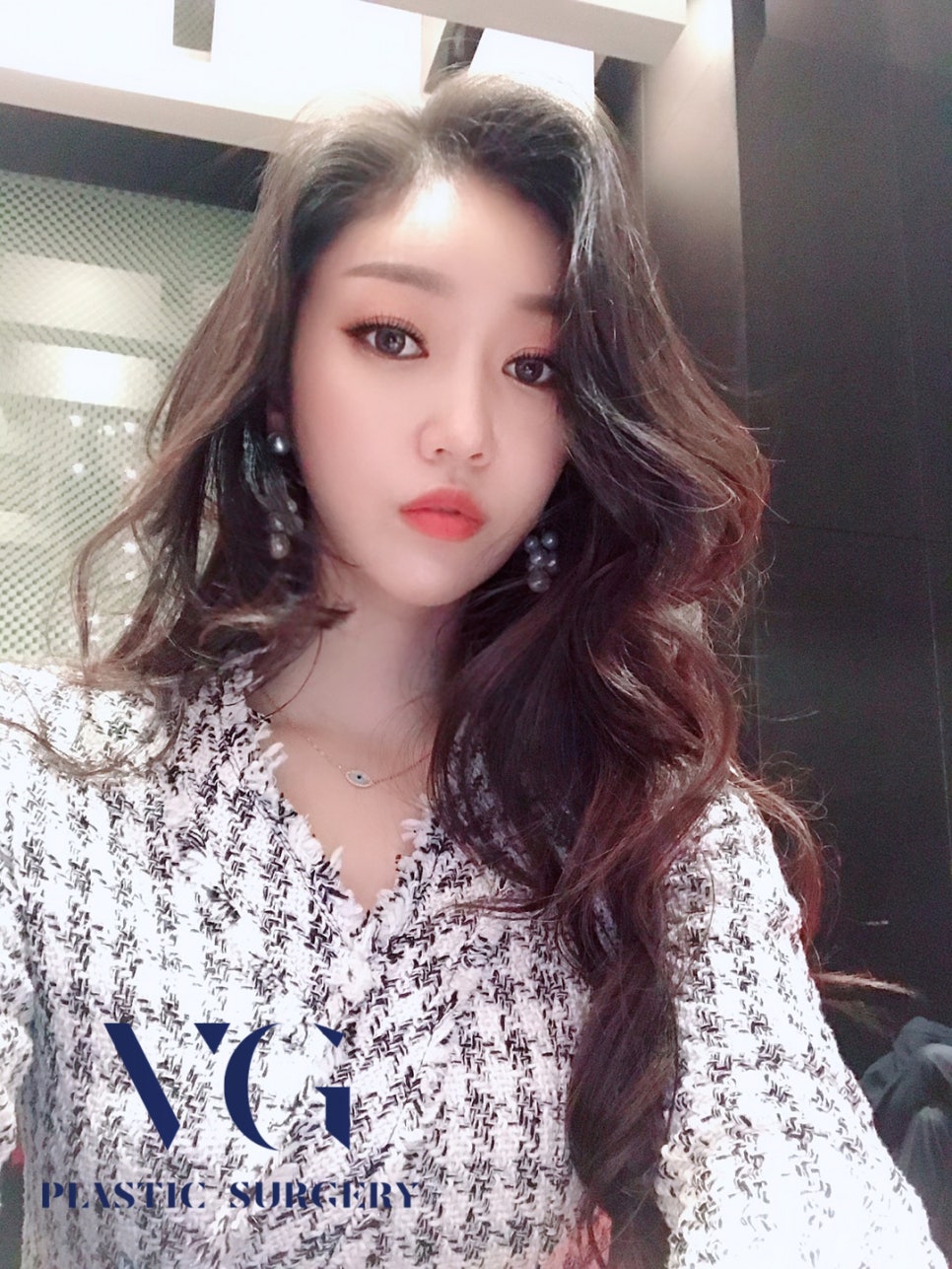 하안검으로 베리굿~하게 젊어지자! 관련 이미지 4