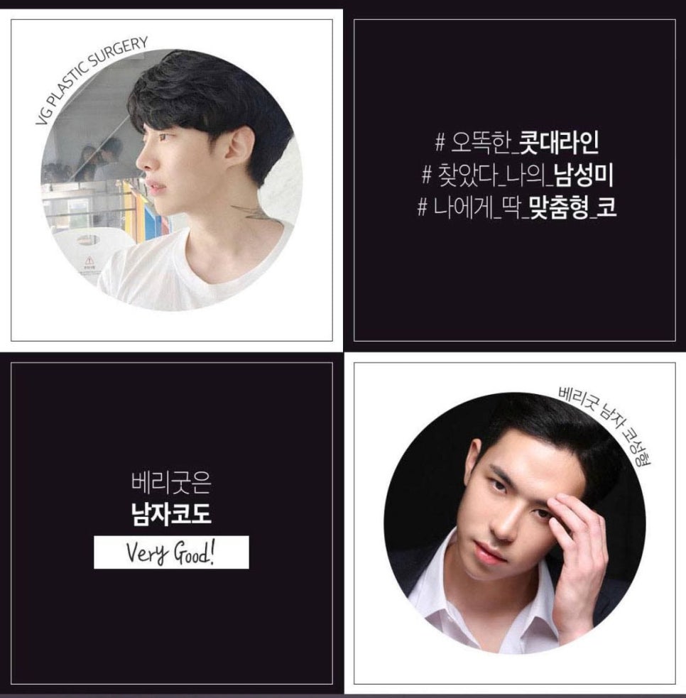 남자코성형,남자코성형가격, 관련 이미지 6