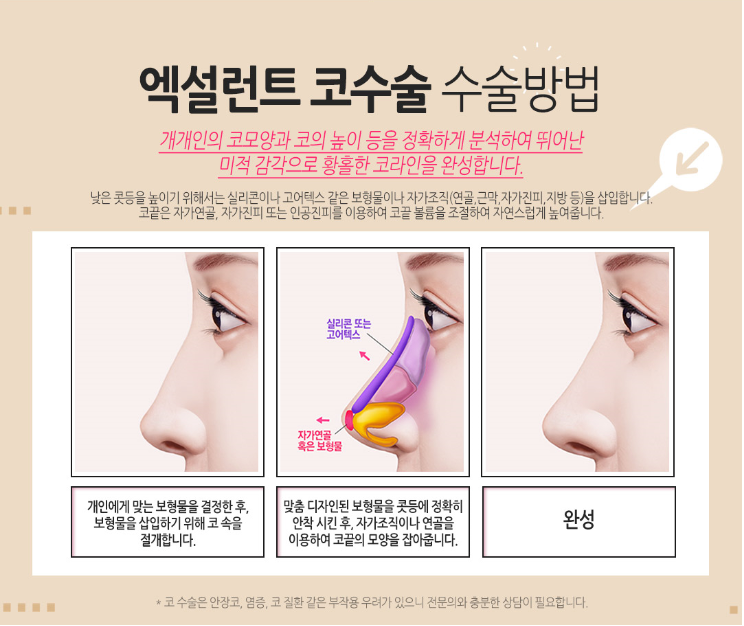 엑설런트코성형으로 콧대높은 자신감 얻자! 관련 이미지 4