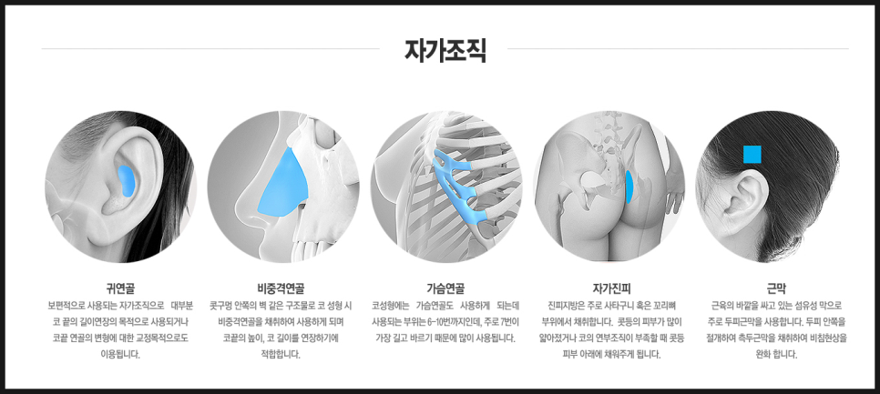 코성형 얼굴전체적인 비율에 맞춰 관련 이미지 3