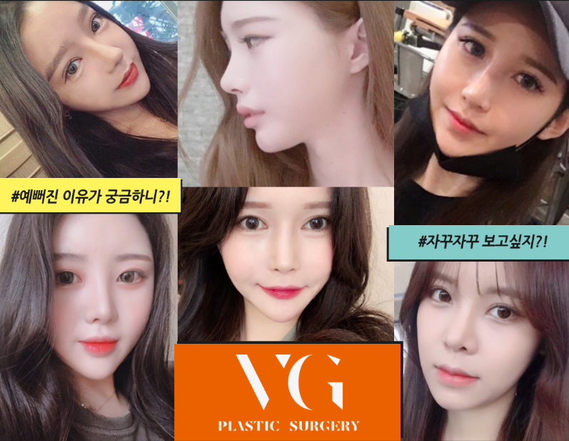 눈재수술 전문, 베리굿성형외과 임영민 원장님 관련 이미지 11