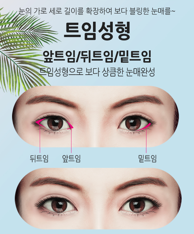 눈성형잘하는곳 내게 맞는 눈매라인에 맞게 관련 이미지 10