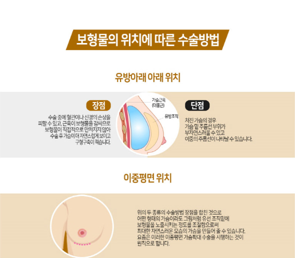 부드러운 촉감에 자연스러운 가슴성형을 찾는다면 베리굿성형외과로! 관련 이미지 6