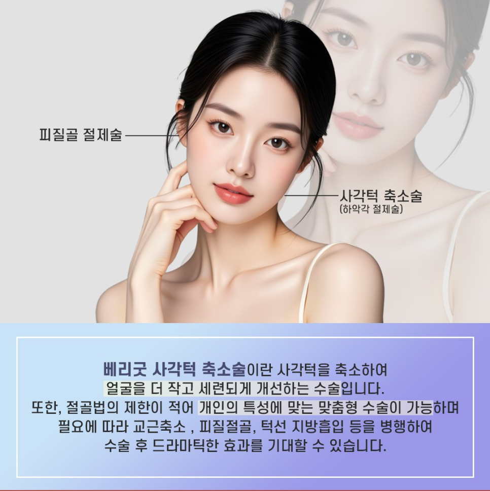 강남역 사각턱축소 수술 전 필수 체크 ? 신경 위치와 절제 범위 분석 중요해 관련 이미지 3