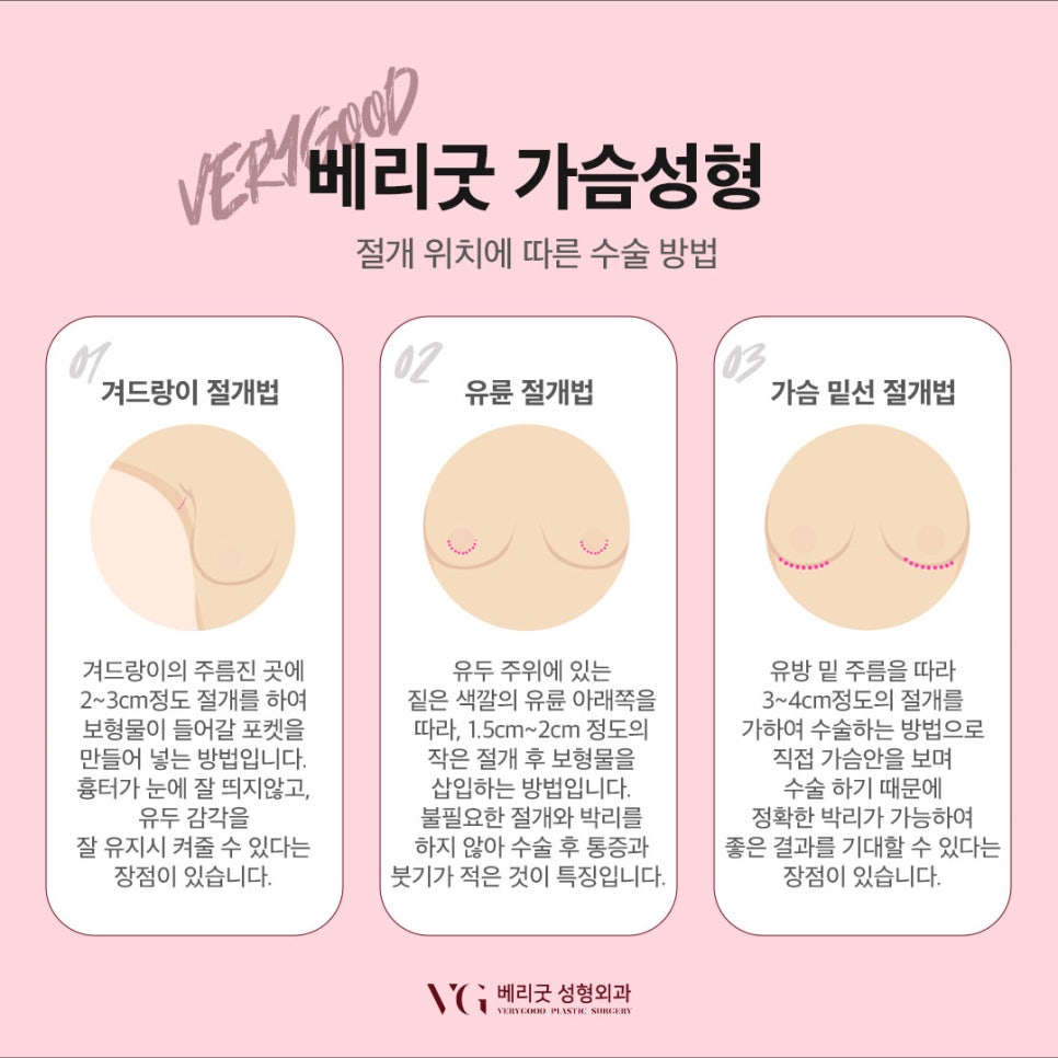 베리굿의 베리굿한 가슴성형 관련 이미지 4