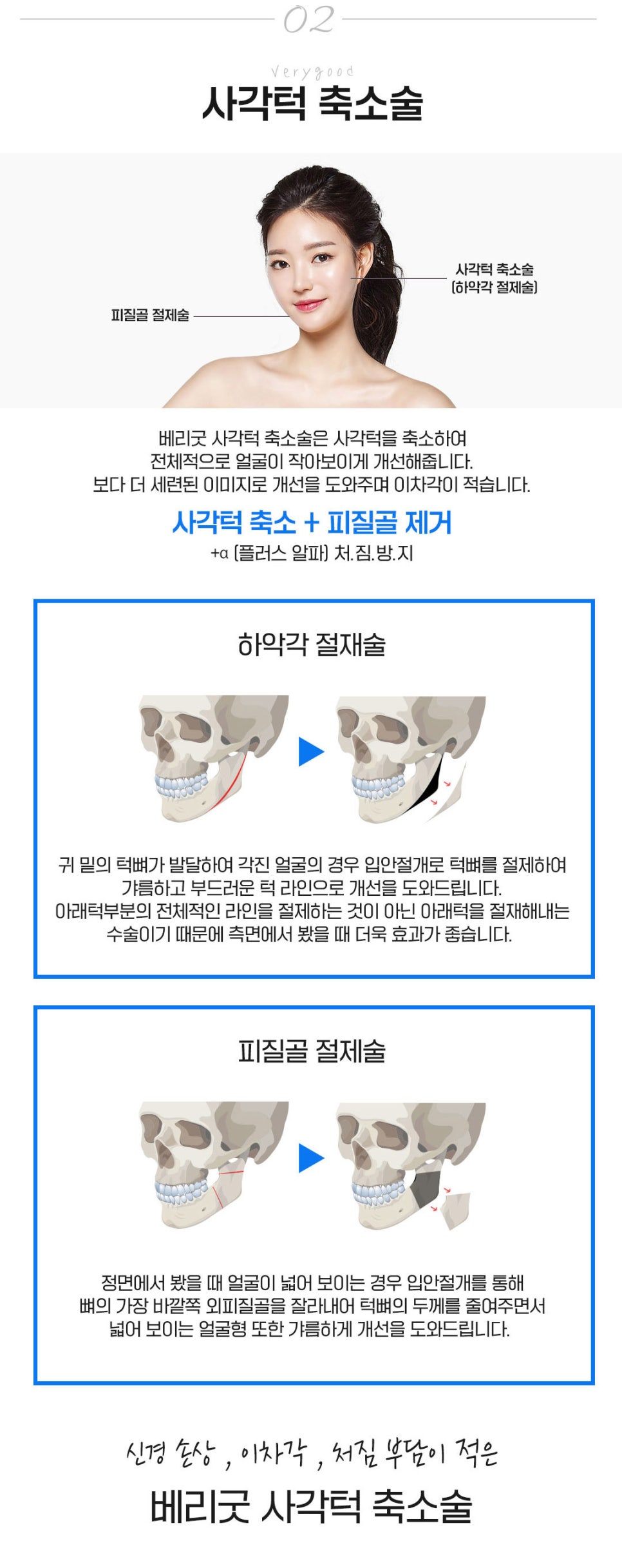 강남역광대축소 베리굿성형외과💜 관련 이미지 6