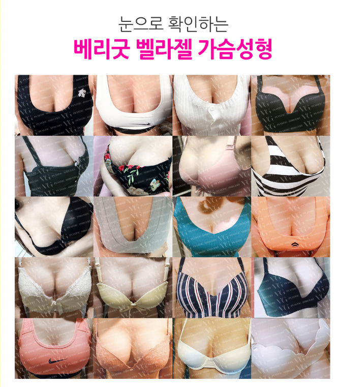 말랑말랑, 촉감이 다른 베리굿성형외과 벨라젤 가슴성형! 강남역성형외과 임영민 원장님 관련 이미지 3