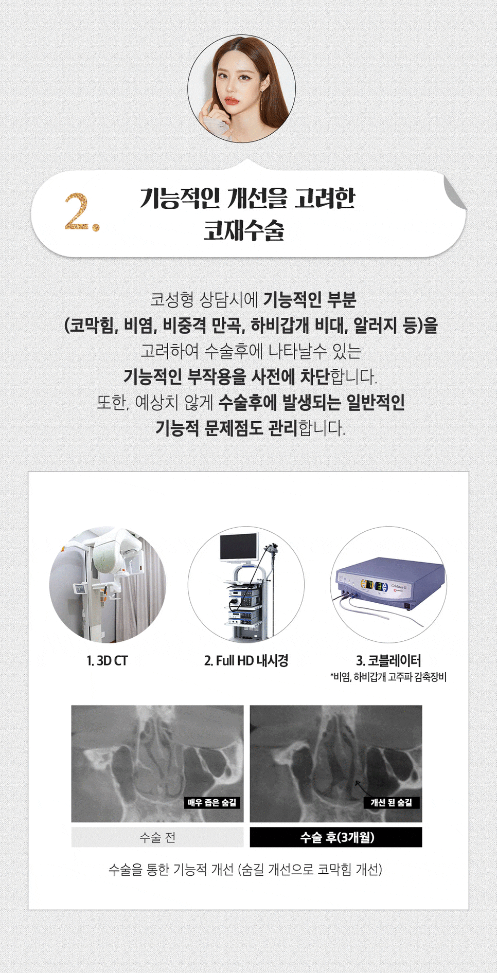 자가연골 코재수술, 기능코 또는 비염까지 한번에 해결 / 강남역 이비인후과 관련 이미지 4