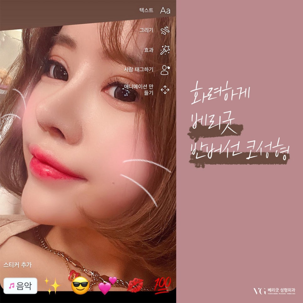 직반코성형 베리굿성형외과😍 관련 이미지 4
