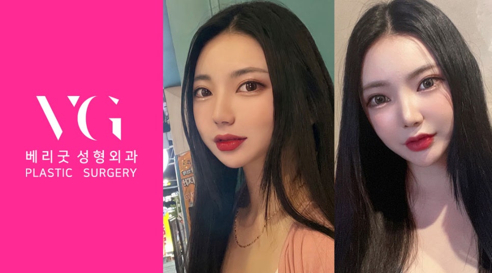 베리굿 안면윤곽💖어디서 봐도 VERY GOOD✨ 관련 이미지 5