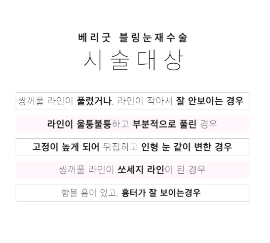 베리굿 눈재수술로 마지막을 완성하다! 관련 이미지 6