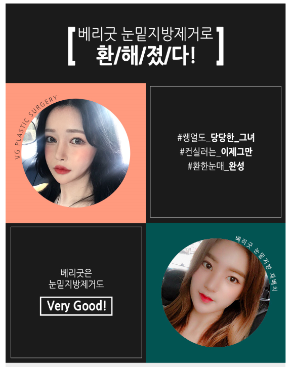 눈밑지방제거, 칙칙하고 그늘진 눈밑 베리굿성형외과에서! 관련 이미지 2