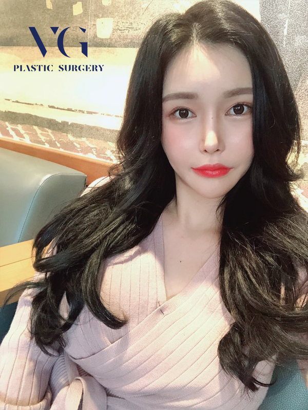 모티바가슴성형 꼭 알아야할 몇가지! 관련 이미지 2