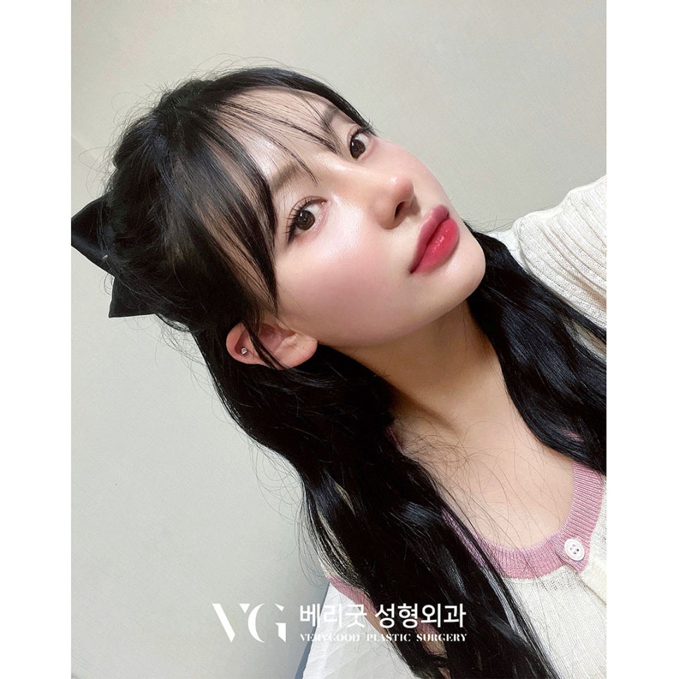 [베리굿성형외과] 강남언니 고객평가 우수병원 7,8,9월 연속 등극 ! 관련 이미지 7