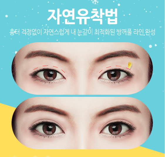 베리굿성형외과 관련 이미지 7