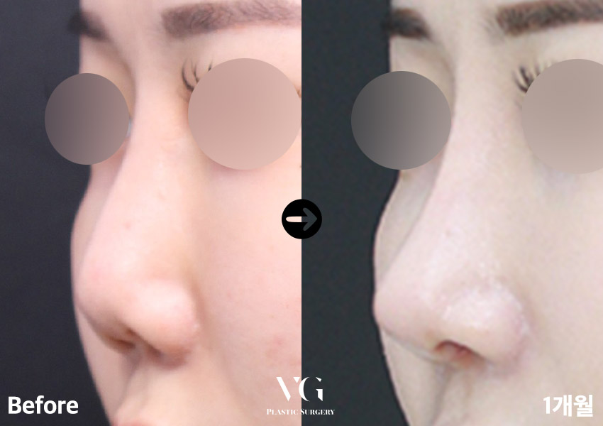 실패한 구축코재수술 베리굿에서 👨&zwj;⚕️✨ 관련 이미지 7