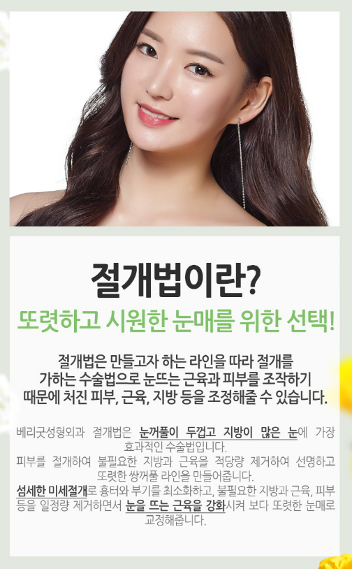 눈성형잘하는곳 잘고르는법 관련 이미지 6