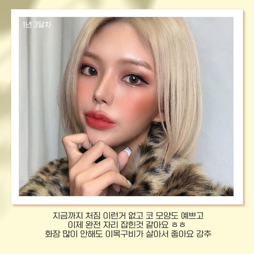 베리굿성형외과가 추천하는 성형별 추천👏 관련 이미지 9