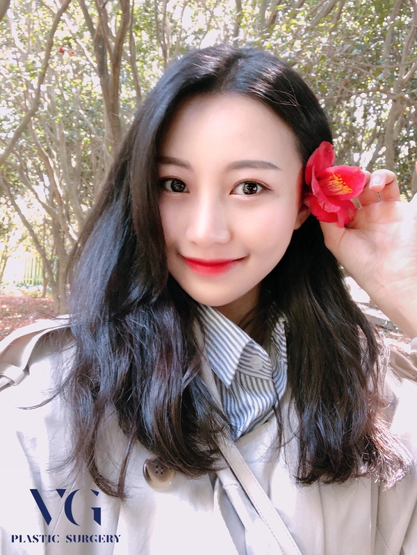 눈밑지방재배치 하고 환한 쌩얼로 자신있게! 관련 이미지 2