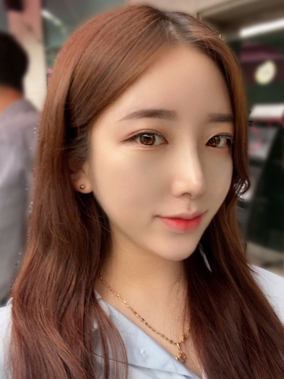 처진피부 슈링크 만으로 탱탱해질까? 관련 이미지 2