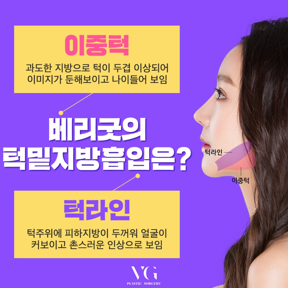 얼굴지방흡입으로 갸름한 v라인으로! 관련 이미지 5