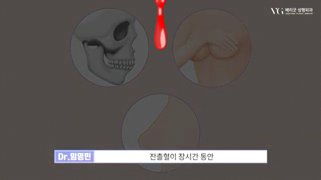 안전성형지향 강남성형외과 , 성형알아볼때 병원 선택법 ? 수혈가능한 병원으로 선택하세요 관련 이미지 18