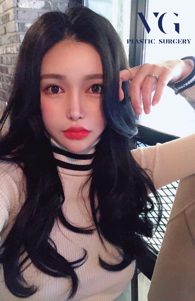 처진살로 울퉁불퉁한 얼굴라인 실리프팅으로 매끈하고 탱탱하게! 관련 이미지 2