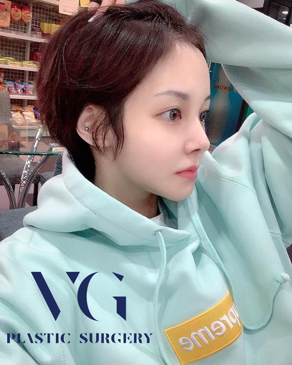 사각턱축소 내게 맞는 라인으로 관련 이미지 1