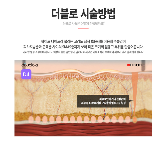 더블로 골드 리프팅으로 나이는 낮추고 탄력은 높이자! 관련 이미지 5