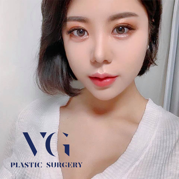 코재수술 더 꼼꼼하고 신중하게 관련 이미지 1