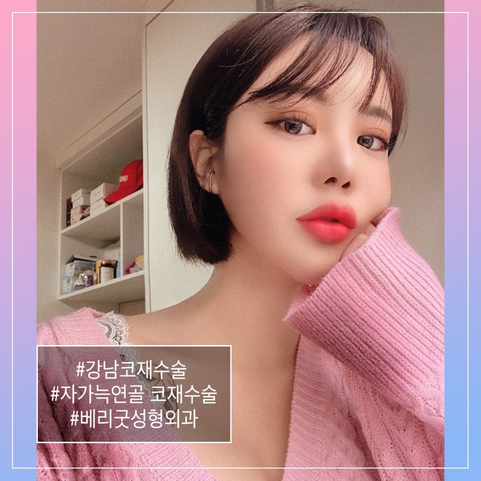 자가늑연골 코성형의 모든것 (코재수술 2탄!) 관련 이미지 1