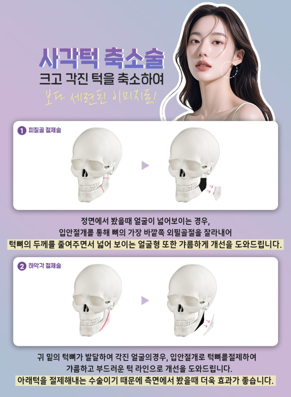 사각턱&middot;광대&middot;턱끝, 강남역 안면윤곽 3종으로 완성하는 황금비율 얼굴 관련 이미지 2