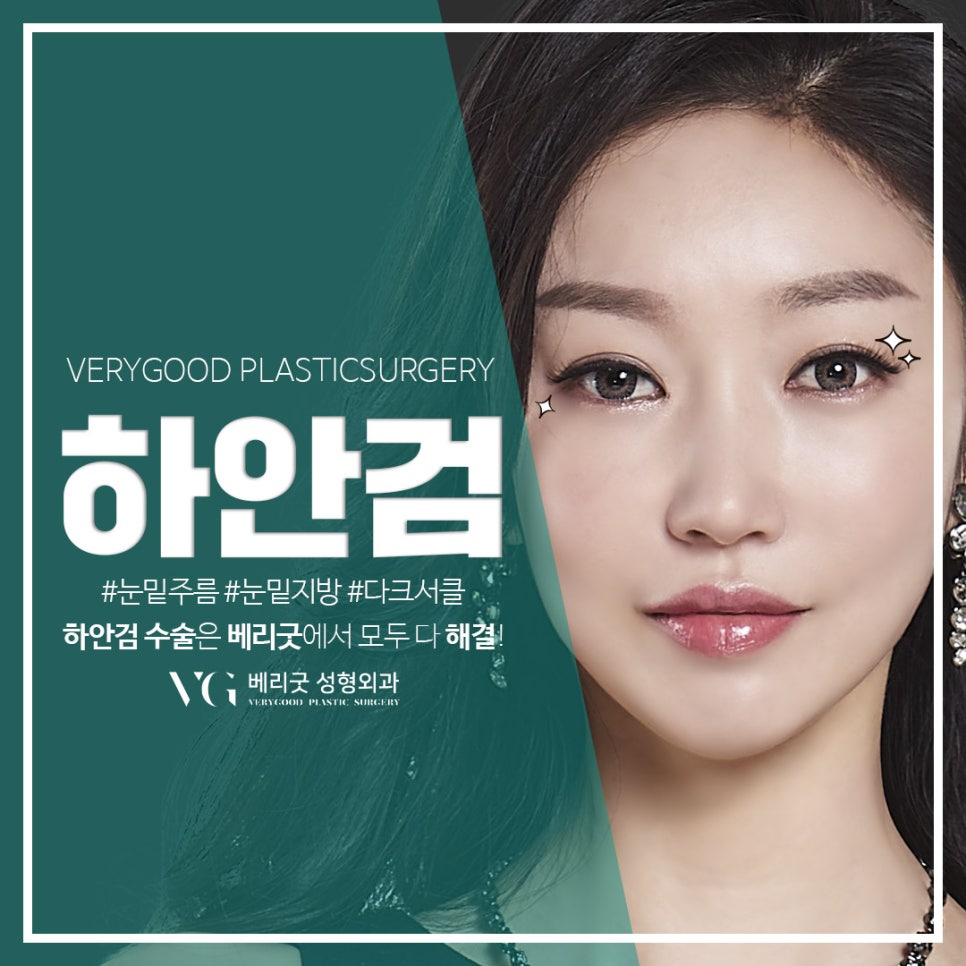 40~50대 눈밑주름고민, 하안검수술로 해결하자! 관련 이미지 1