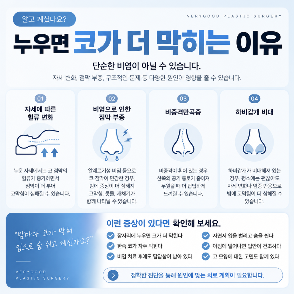 누우면 코가 더 막히는 이유는? 밤마다 반복되는 코막힘과 비염코수술 관련 이미지 3