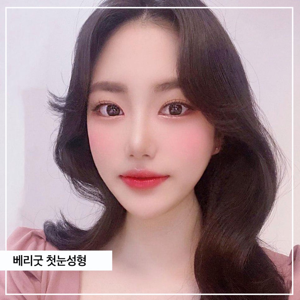 베리굿성형외과💖첫눈성형도 베리굿하게🎄 관련 이미지 9