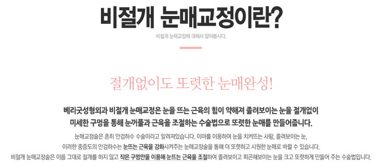 남자눈매교정전후 확실하게 관련 이미지 2