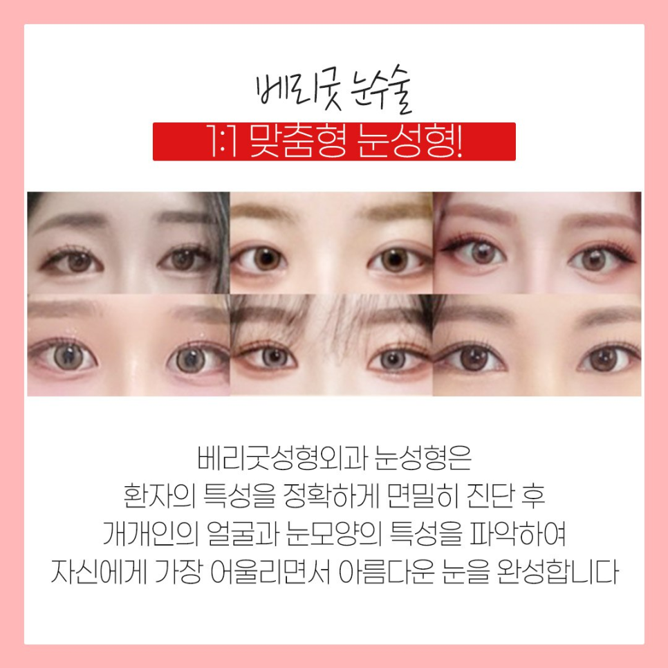 눈코수술후기 , 붓기 쌍수 코성형 회복기간 궁금하다면 관련 이미지 5