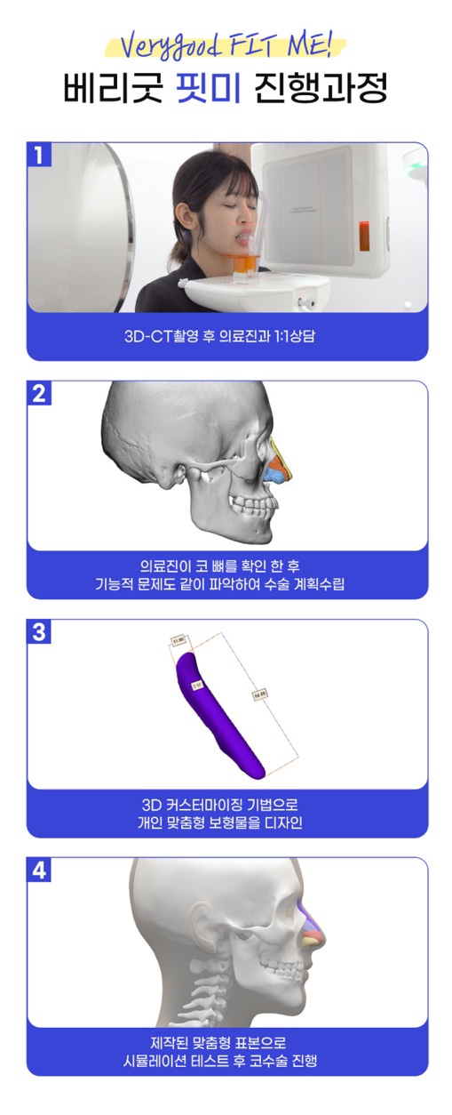 강남역 코재수술 , 나에게만 딱 맞는 3D 맞춤형 보형물으로 관련 이미지 5