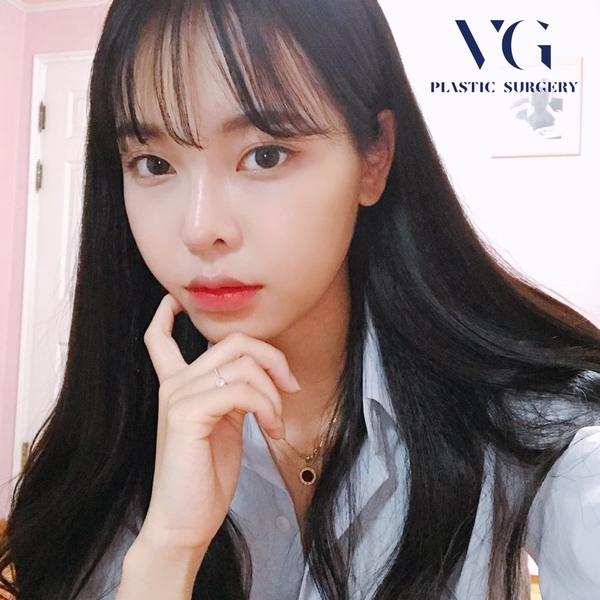 얼굴지방이식잘하는병원 매끄럽게 잘하는곳으로! 관련 이미지 1