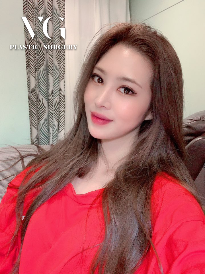 눈재수술, 원인과 상태에 따라 방법도 바뀐다? 관련 이미지 1