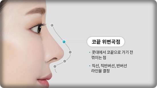 코성형, 얼굴 균형을 고려한 5가지 핵심 포인트 관련 이미지 2