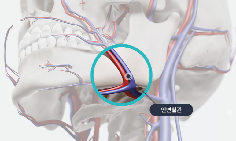 Facial Contouring Surgery: Is a Three-Area Procedure Really Necessary? image 2